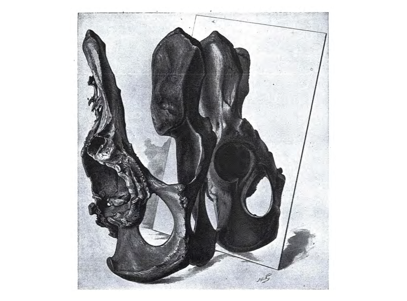 Pelvis-in-mirror image from Moodie’s 1930 paper